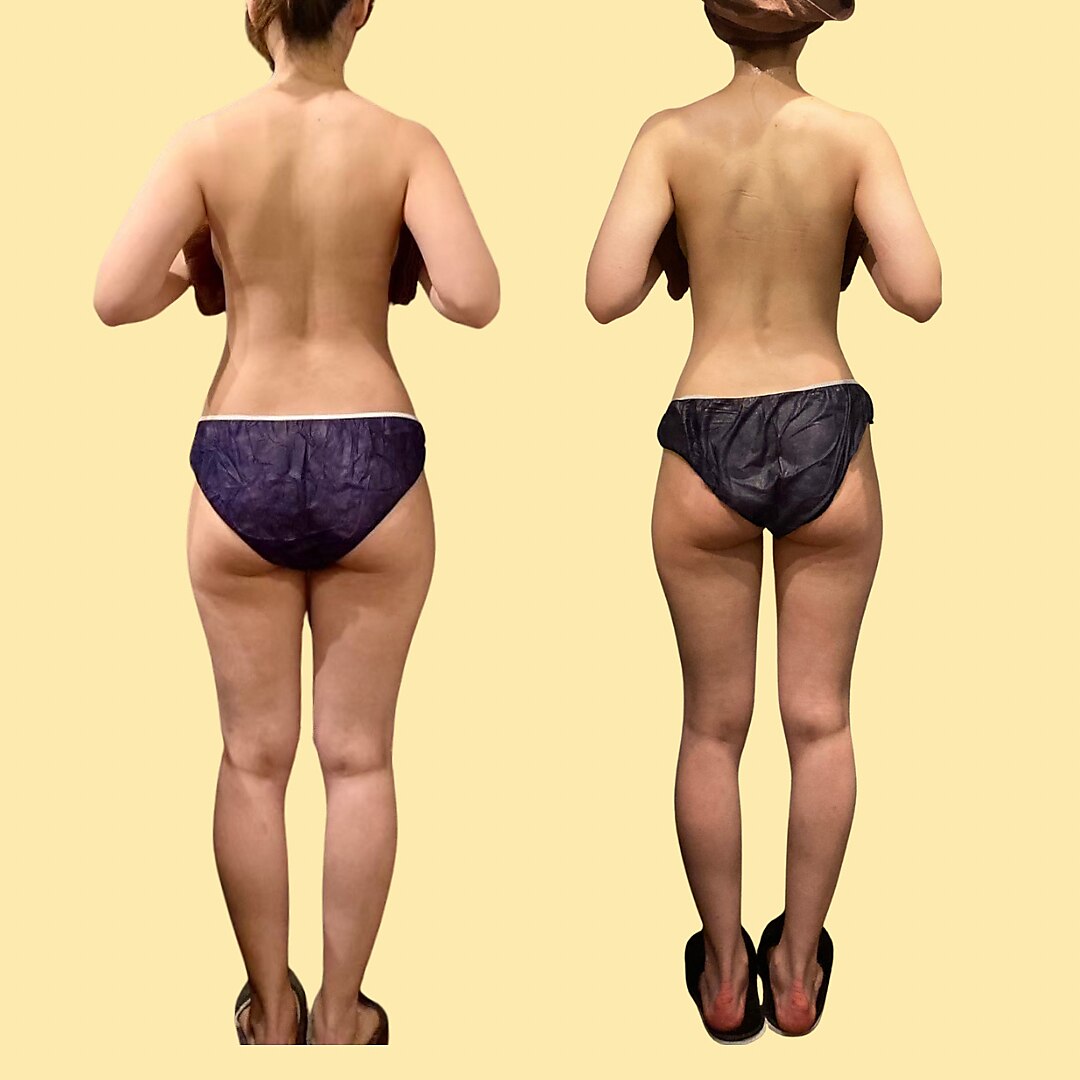 クーポン・メニュー｜琥珀 アザブ(AZABU)｜ホットペッパービューティー