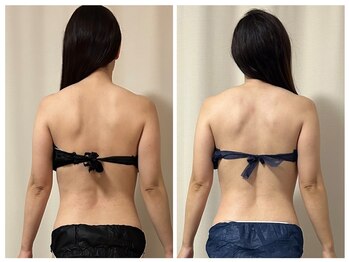 ひぺりかむ/【リンパドレナージュ】《弐》