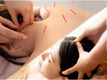 リリーフ(relief)の写真/女性専用★完全個室　眼精疲労/頭コリ/スマホ首/頭痛/腰痛/食いしばりエラ張り改善！肩こり鍼施術も♪