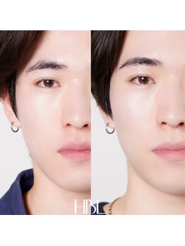 テンディ(TenD.)/【HBL】