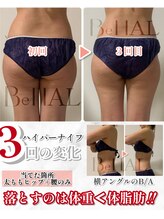 ビナル(BeNAL)/痩身☆ハイパーナイフB/A