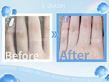 ストラッシュ 池袋駅前店/施術例：指