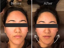 アウフハベン(Aufheben)の雰囲気（那覇初！小顔に導くリリースカッター取り扱い[マッサージ/小顔]）