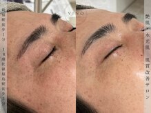 ヴィノ フクシマ(VINO fukushima)の雰囲気（水分と栄養補給目元のシミ・しわ改善肌に必要なケアを見極めます）