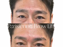 アイ ビューティー インクリース 岸和田店(Eye beauty increase)/メンズブロウリフト★