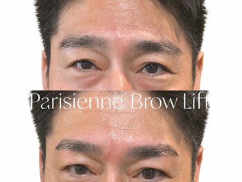 アイ ビューティー インクリース 岸和田店(Eye beauty increase)/メンズブロウリフト★