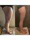 サロン ド ミル(Salon de Mille)の写真/【本気でボディラインを変えていく】筋膜・脂肪・骨膜の癒着に着目するSalon de Milleの痩身手技で美しく!