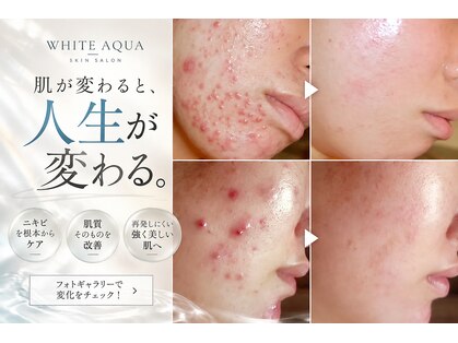 ホワイトアクア 鳳店(WHITE AQUA)の写真