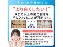 ☆歯科提携☆プレミアムホワイトニング