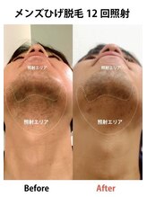 アネル 浦添店(anel)/