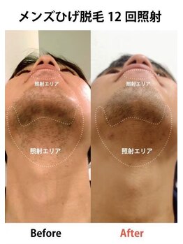 アネル 浦添店(anel)/