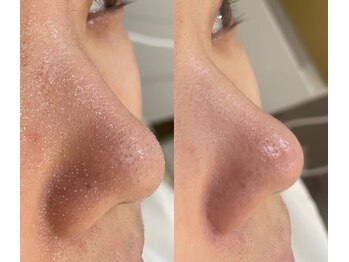 スターラッシュ(Star Lash)/