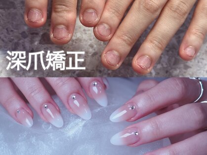 パズルリングネイル(Puzzle.ring Nail)の写真