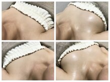 キヌ(KINU)/もちふわバストケア