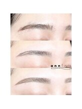 アンフィズム(annfism)/