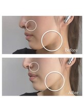 トノ(TONO)/before→after