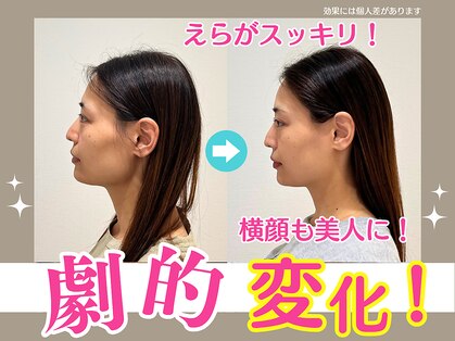 上越かがやき整体院の写真
