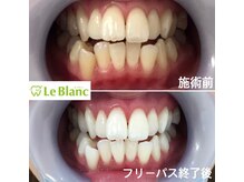 ルブラン 奈良店(Le Blanc)/33000円で