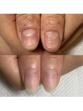 カンパニュラ(Campanula)/自爪育成コース