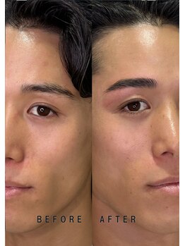 エーダブトーキョー 恵比寿店(Awww! tokyo)/アイブロウ×アイラッシュ