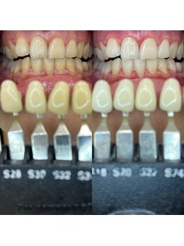 トウキョウスワーズ 池袋店(TOKYO SWRS)/#ホワイトニング #池袋 #渋谷
