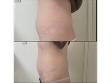 エクリル(Eclire)/下腹ポッコリ/厚み