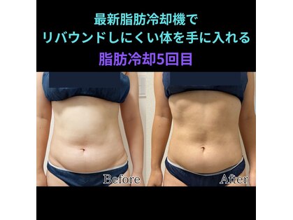 ホワイトビューティーラボ(White Beauty Lab)の写真
