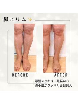 ナイスデイ(Niceday!)/脚スッキリ!!