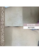 モアトゥインクル 山口店(MORE twinkle)/★症例写真★【20代】