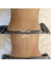 グレアージュ(GLEAGE)/