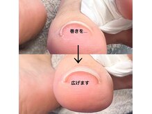 リンダ(Linda)