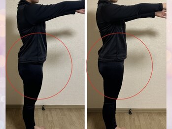 ヨサパーク スイ(YOSA PARK SUI)/ビフォーアフター