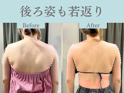 フローフシ∞の写真