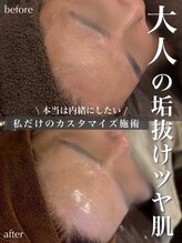 ジェノール 2nd beauty studio 姫路駅前店(JNOEL)/大人の垢抜け艶肌！