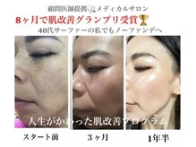 デアマリスの雰囲気（何年も悩んできたシミ悩みデアマリスで解決！結果重視・根本から）