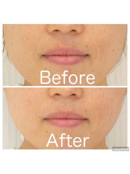 エムデコビューティ(M-DecoBeauty)の写真/キャンペーン価格！シミ・シワ・たるみ・大人ニキビなど悩みに合わせた結果重視のエステをこの機会に◎