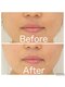 エムデコビューティ(M-DecoBeauty)の写真/キャンペーン価格！シミ・シワ・たるみ・大人ニキビなど悩みに合わせた結果重視のエステをこの機会に◎
