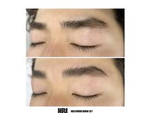 ブリリアント シェル(Brilliant Shell)/HBL☆Before→After