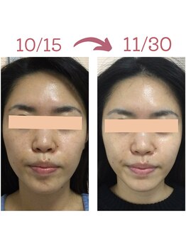 シーフェイス(see face)/圧倒的透明感を