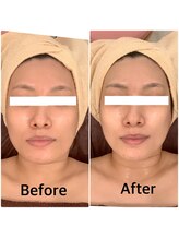 スペチアーレ 夙川/美顔革命