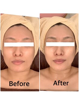 スペチアーレ 夙川/美顔革命