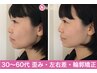 【左右差・歪み・鼻・エラ】立体的にパーツが整う本格 小顔矯正◇70分￥9,800