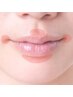 【ピンポイント脱毛】口周り(女性) 【回数：1回】