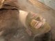 サロンドビジュー(salon de bijou)の写真/＼口コミ高評価／最新複合機×高橋ミカ直伝エステ【肌質改善！ニキビ肌ケア&SPハーブピーリング¥12800】