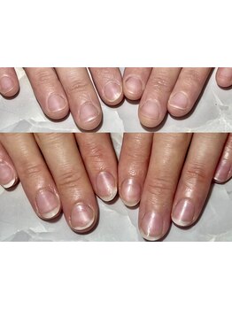 爪の悩みを解消できる（ケア含む）