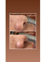 シュエット(CHOUETTE)/