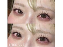 キュアバイアニーアンドジーノ(Qa by Annie&Gino)/エクパ＆アンドヘルシー