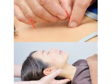 西小山弁天通り 鍼灸治療院の雰囲気(肩凝り・頭痛・腰痛を根本からケアする鍼灸×整体)