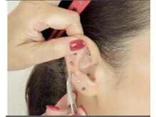 ミリーズ(Millie's)/耳ツボジュエリー大人気の施術