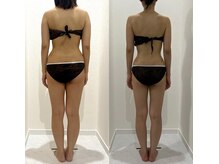 ヴィナーレ(VINARE)/痩身/全身キレイにサイズダウン